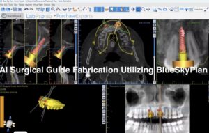 BlueSkyBio AI Surgical Guide: Wizard Mode